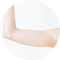 脂肪除去可能部位 二の腕 のイメージ